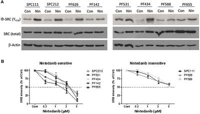 Nintedanib and Dasatinib Treatments Induce Protective Autophagy as a Potential Resistance Mechanism in MPM Cells